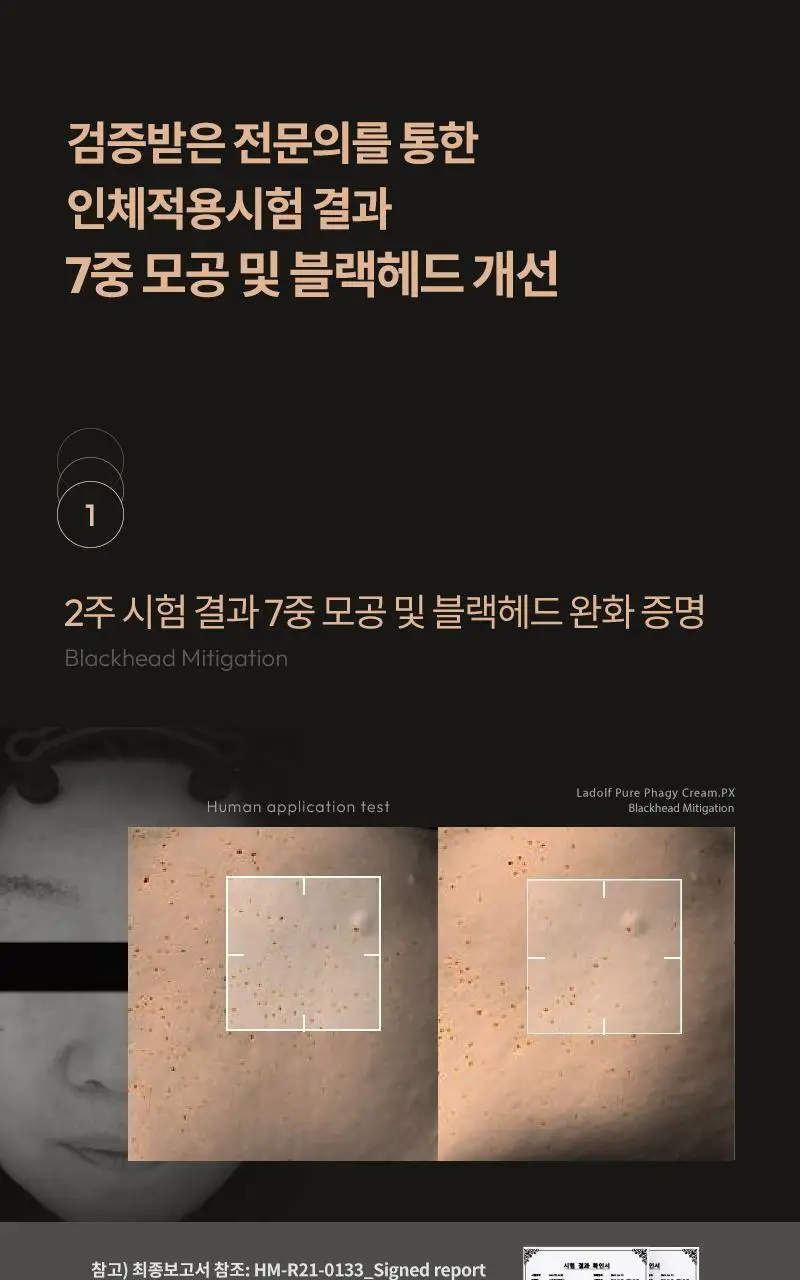 [피지캐는크림] 라돌프 퓨어파지 크림 알엑스 80g 상세페이지 20